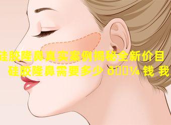 硅胶隆鼻真实案例揭秘全新价目「硅胶隆鼻需要多少 🐼 钱 我来告诉你」